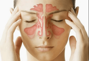 علت بوی بد دهان (هالیتوزیس)